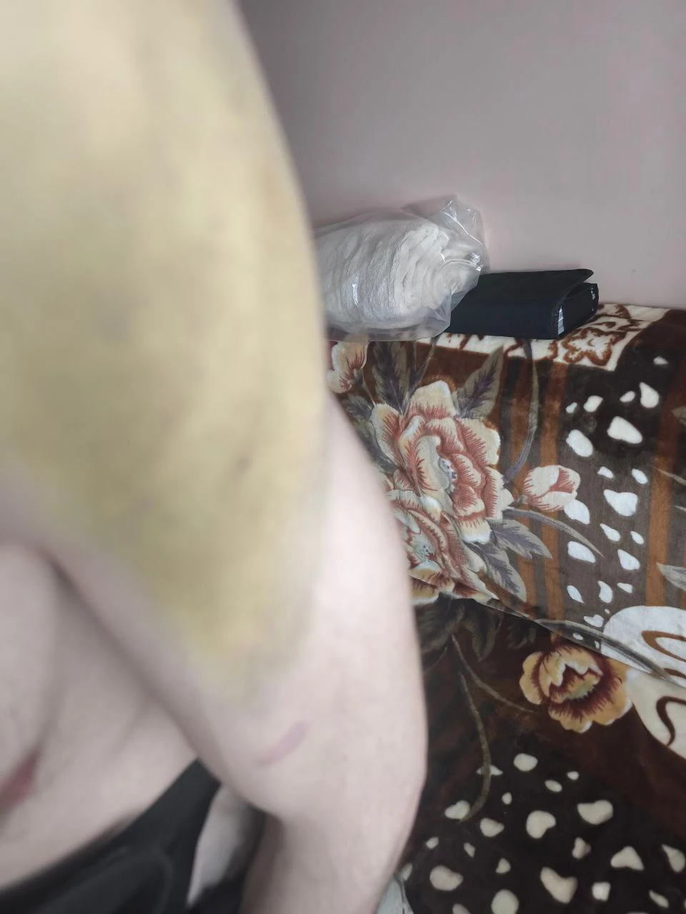На Тернопільщині суд розглядає справу про побиття ветерана: родина вимагає 5 мільйонів компенсації