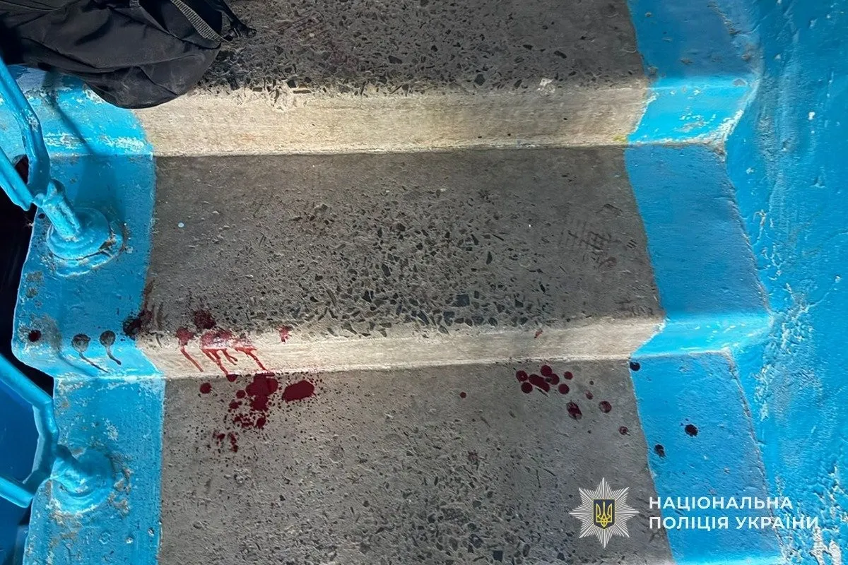 Ніж у шкільному конфлікті: у Тернополі підліткова сварка закінчилась реанімацією